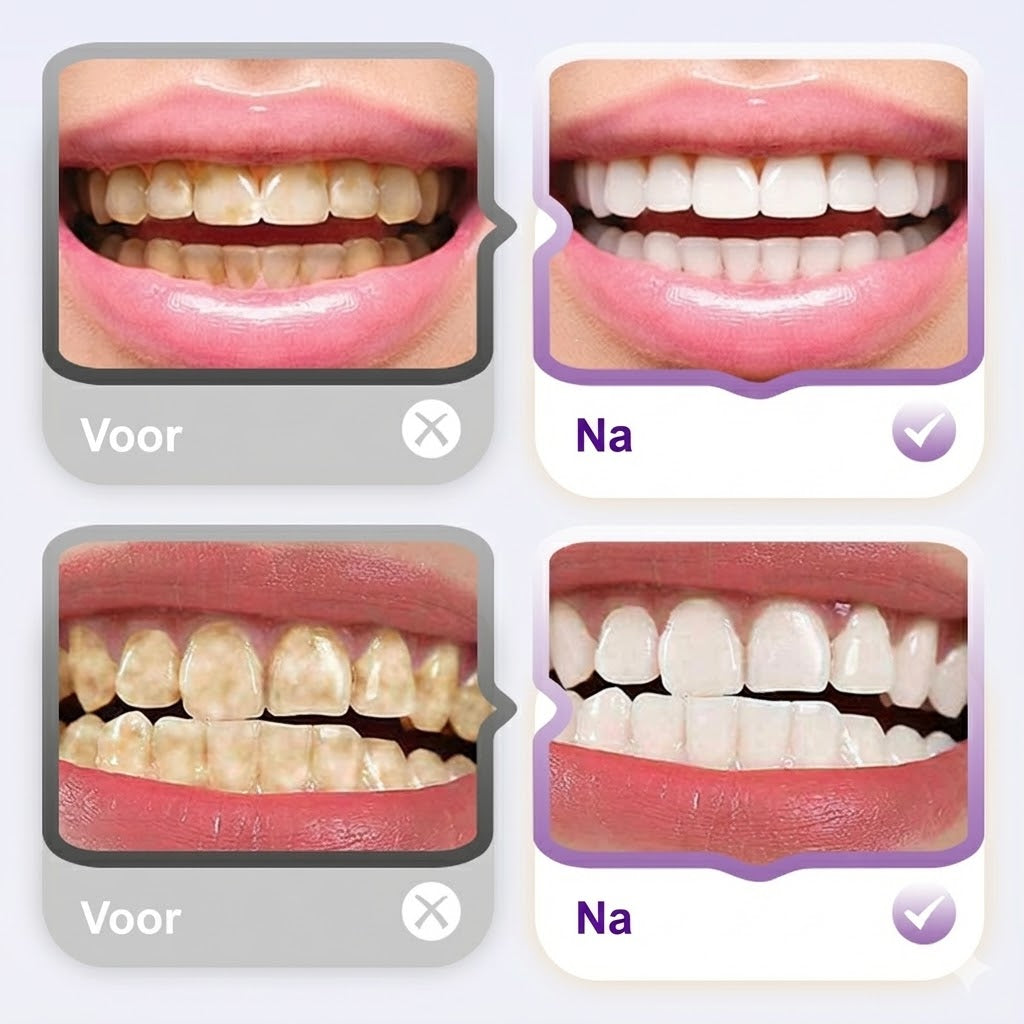 Lysozyme Verhelderende Vlekverwijderende Tandpasta